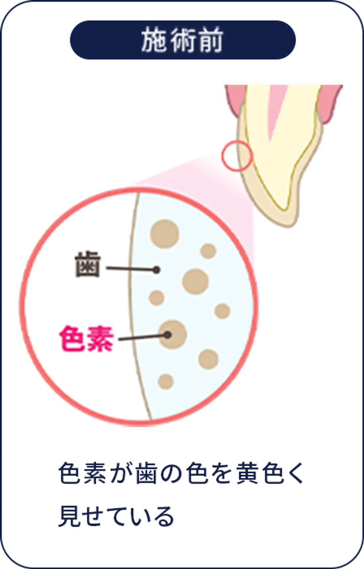 施術前